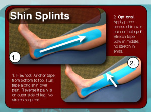 Sporttape