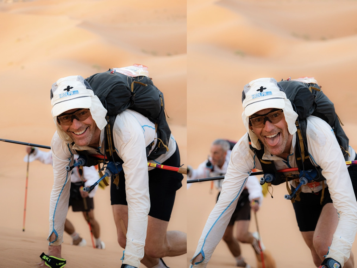 Handen en voeten na dagen lopen in de Marathon des Sables