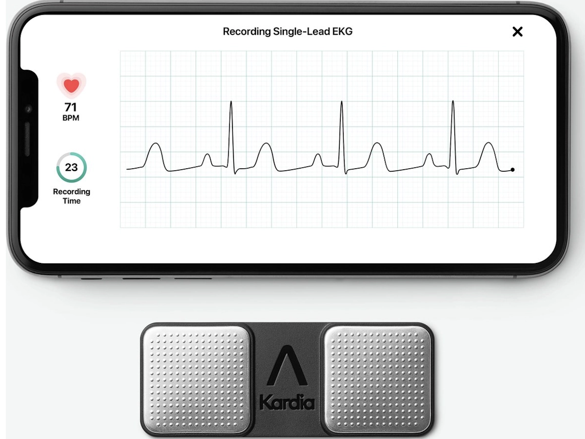 Kardia ECG meter