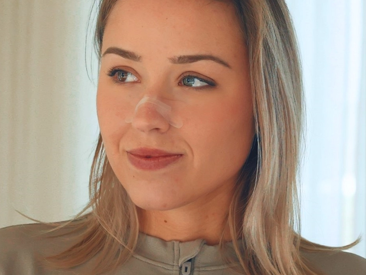 Resty pleister op neus bij vrouw